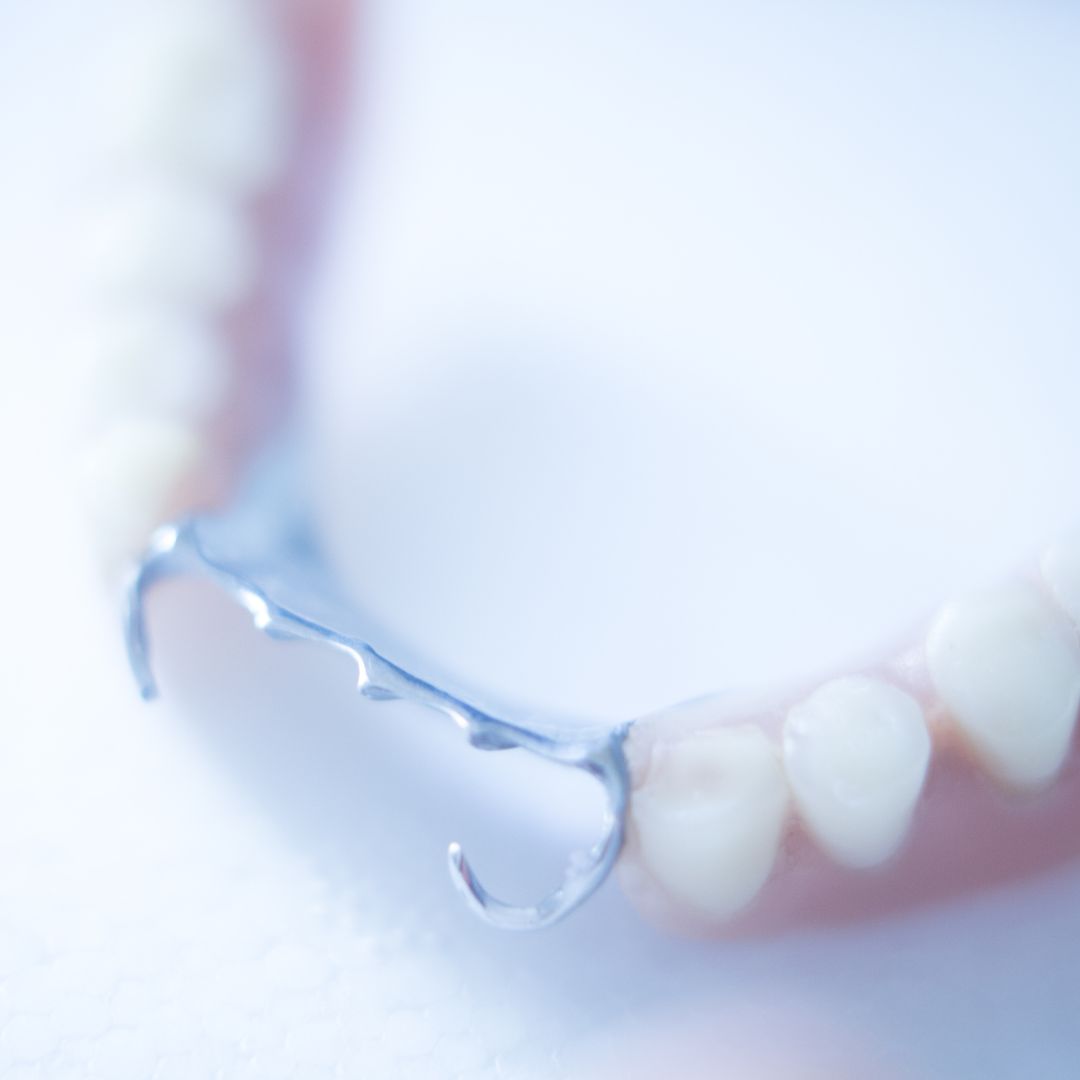 Partial_Dentures_Baldivis[1]