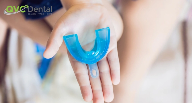 Are Custom Mouthguards Worth It?